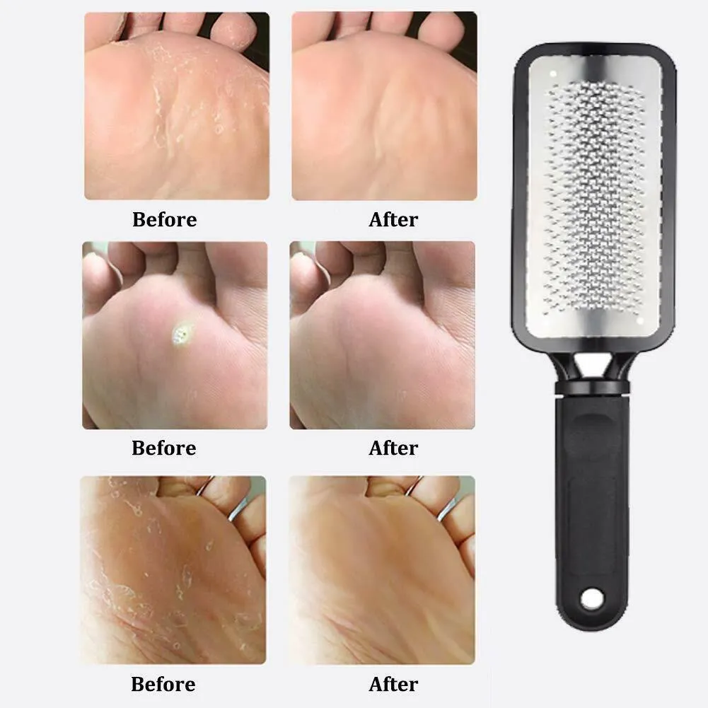 Professional Foot Callus Remover File Rasp Scraper