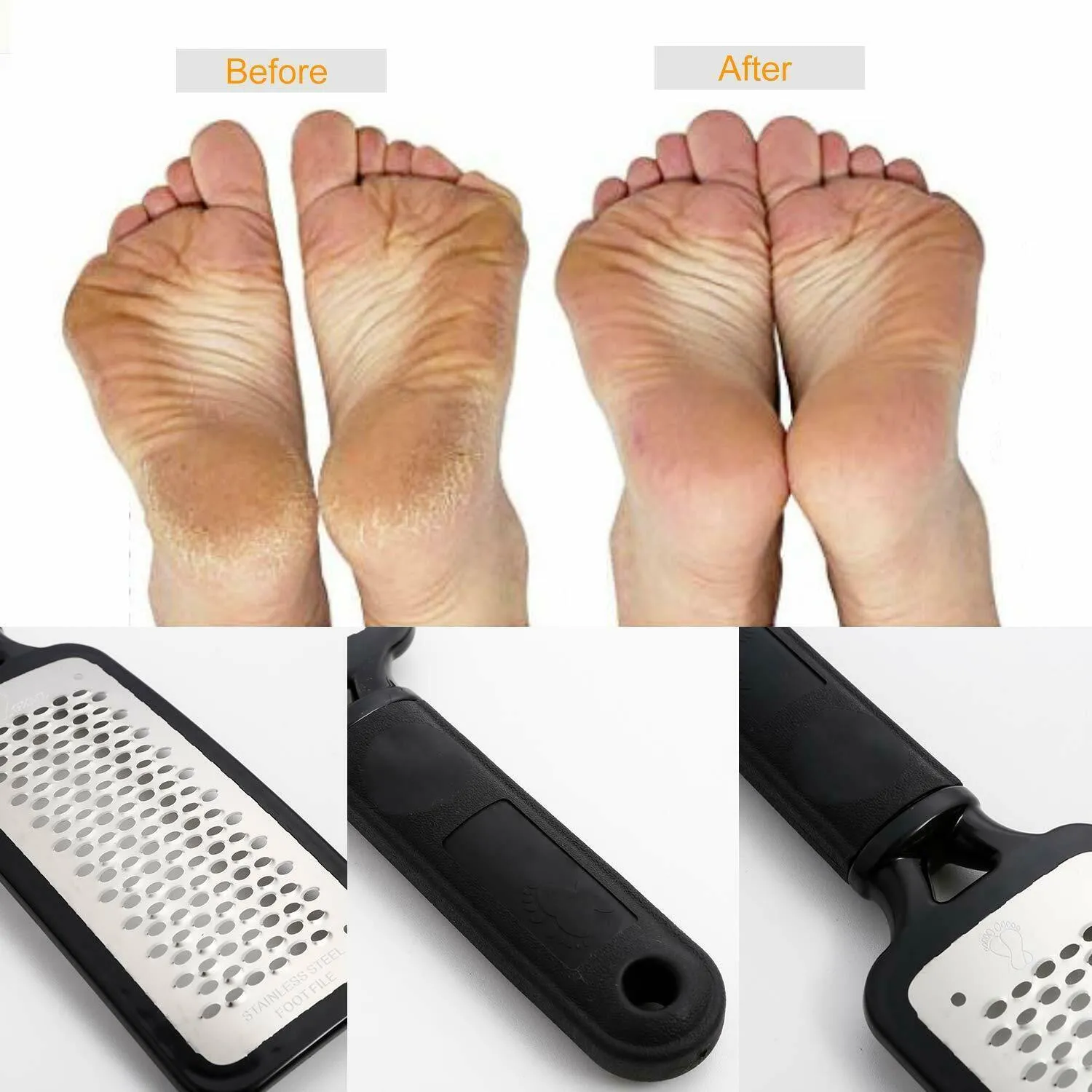 Professional Foot Callus Remover File Rasp Scraper