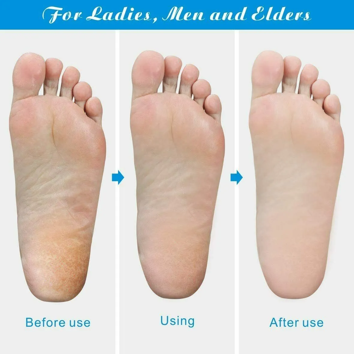 Professional Foot Callus Remover File Rasp Scraper